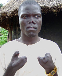 LRA victim