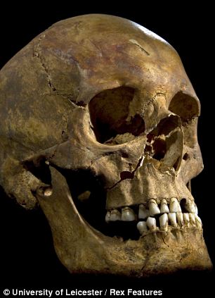 Richard III's teeth