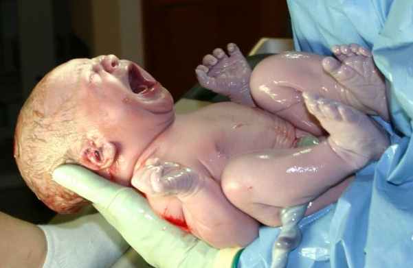 Newborn baby seconds after delivery