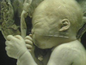 9 month old fetus