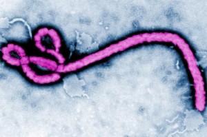 Ebola virus