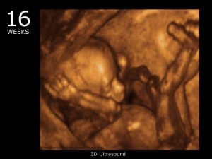 16_week_ultrasound_3d
