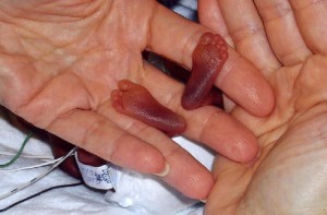 Premature baby feet