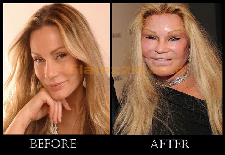 Jocelyn Wildenstein