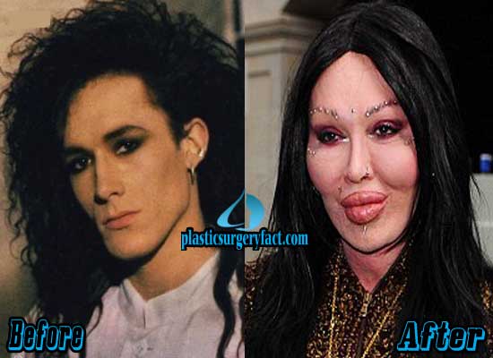 Pete-Burns-Plastic-Surgery-Before-and-After
