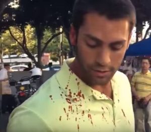 Sucker punched Trump supporter